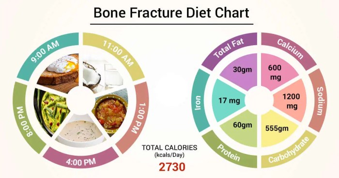 Bone health bones healthy infographic symptoms tips signs fractures treatment diet lifestyle nutrition